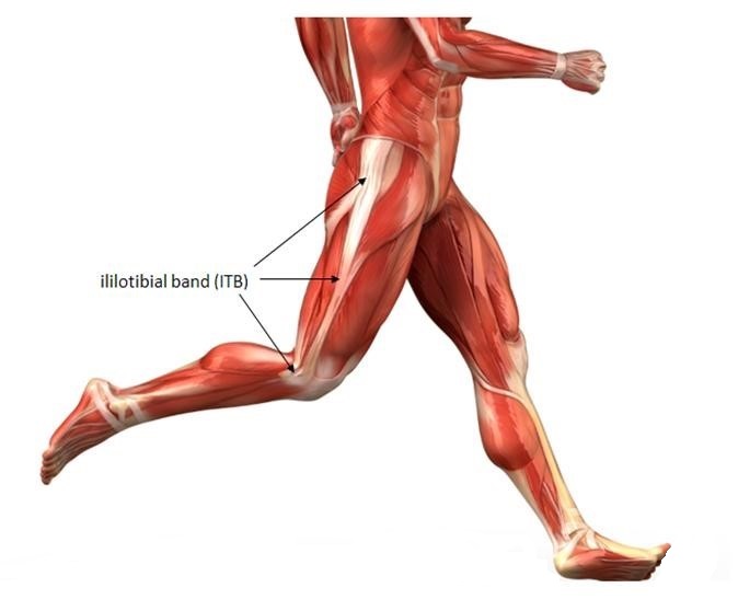 Iliotibial Band Friction Syndrome (ITB Friction Syndrome)